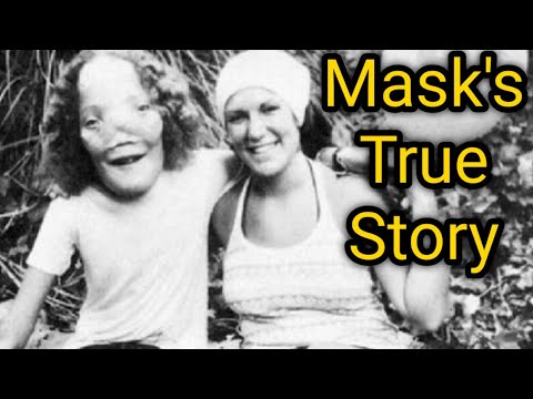 The Real Life Of Rocky Dennis