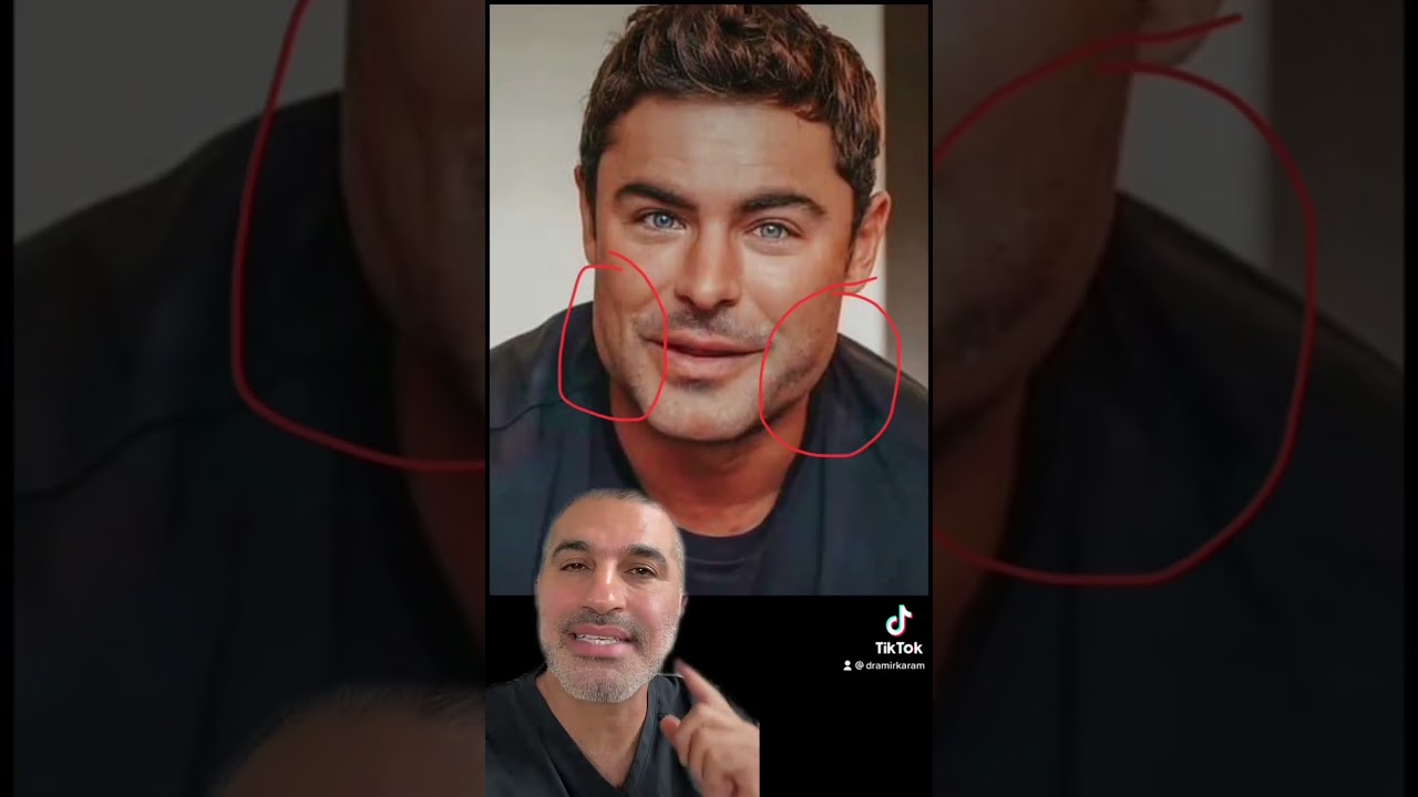WHAT HAPPENED to Zac Efron's Jaw? Plastic Surgeon Explains!