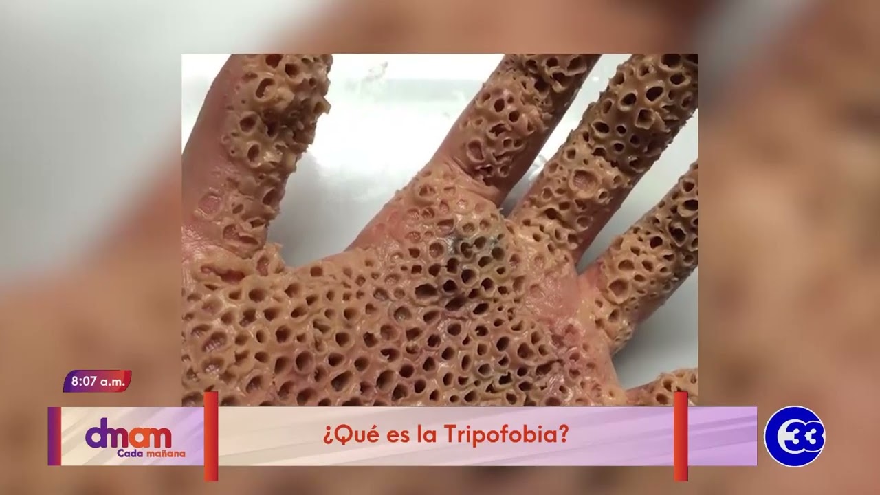 #DeMujerAMujer | ¿Qué es la Tripofobia?
