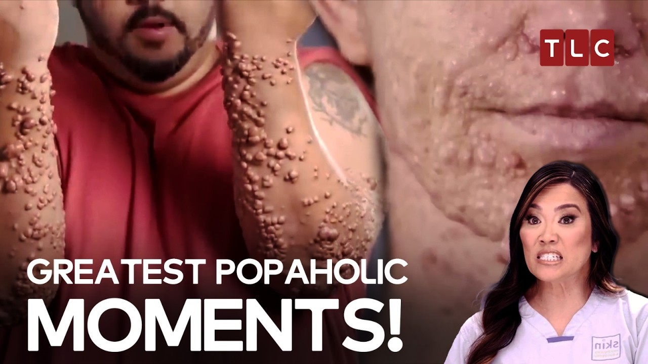 Best Cyst Removals by Dr Lee! - Dr Pimple Popper TLC