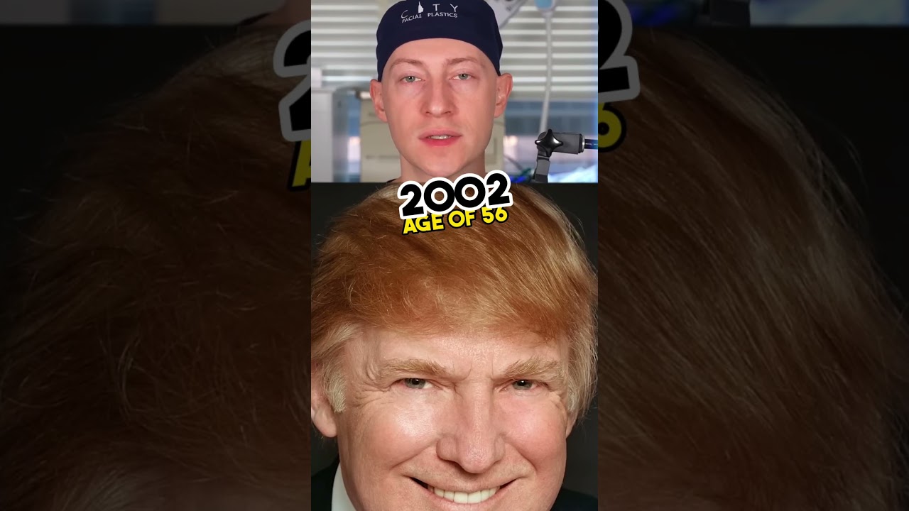Did Donald Trump Have A Hair Transplant?