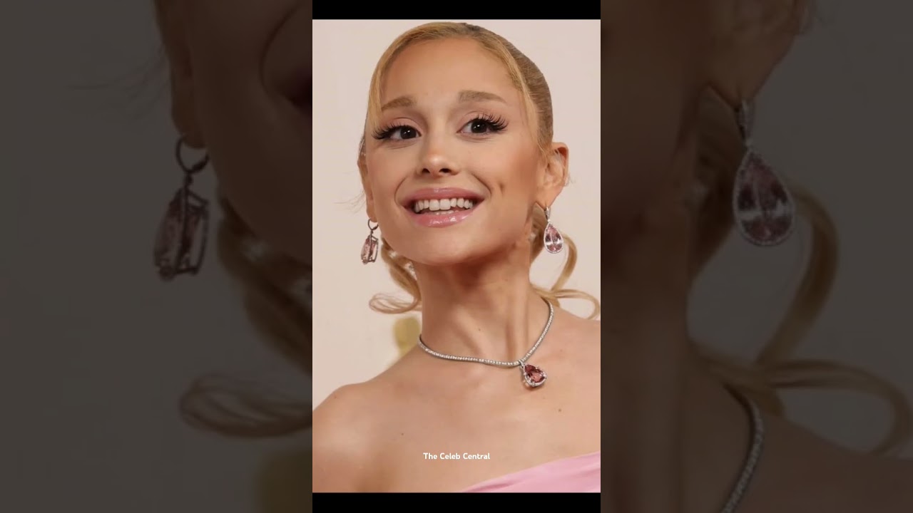 Famous Faces Before and After Cosmetic Procedures