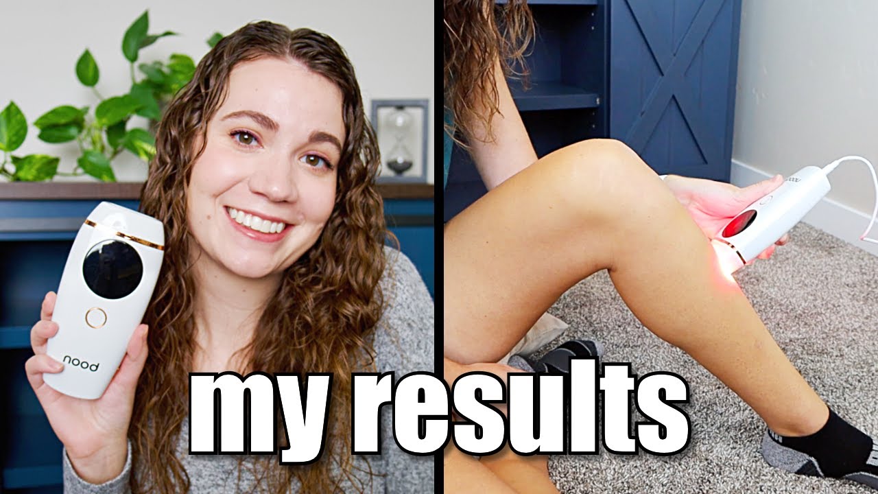 MY RESULTS | Nood The Flasher 2.0 | at home IPL hair removal