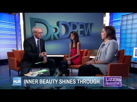 CNN: 63-pound woman, Lizzie Velasquez can't gain weight