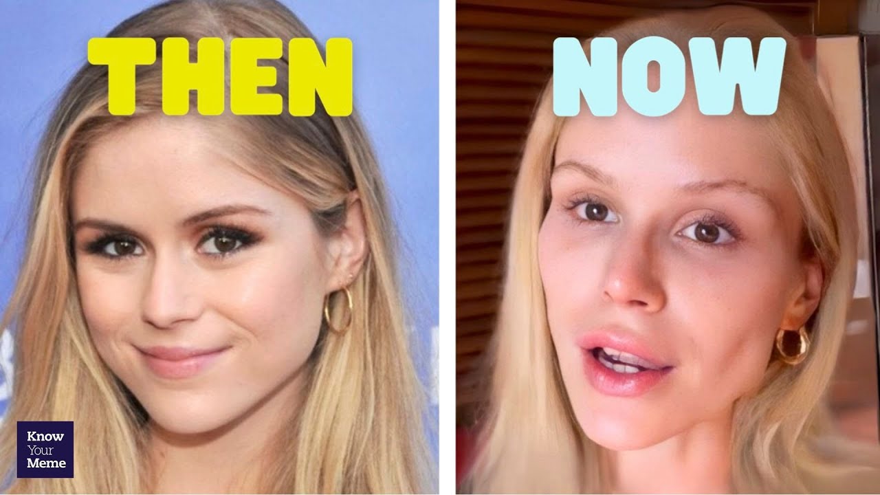 Starlight Looks Different... Erin Moriarty Selfies Spark Cosmetic Surgery Rumors and Memes